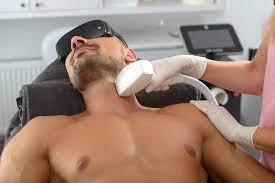 laser hair removal manchester